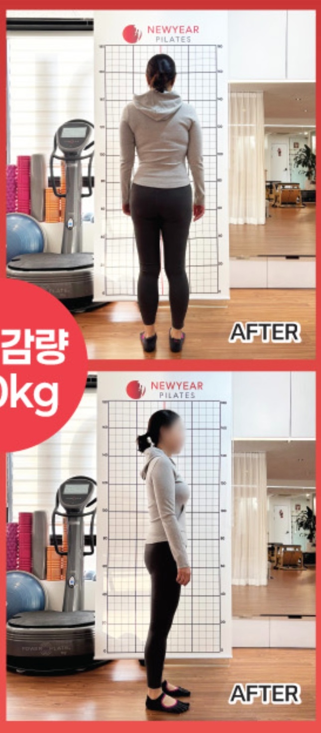 교정 후 (After)